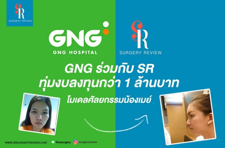 GNG ร่วมกับ SR